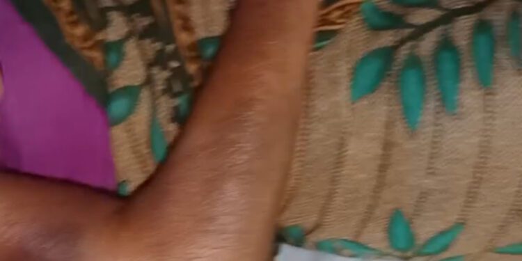 রমজানে প্রকাশ্যে পান খাওয়ায় মুসলিম প্রতিবেশীর আক্রমনে আহত হিন্দু নারী 1 রমজানে প্রকাশ্যে পান খাওয়ায়  মুসলিম প্রতিবেশীর আক্রমনে আহত হিন্দু নারী